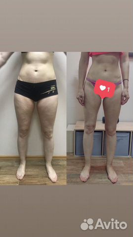 LPG массаж на оригинальном аппарате vortex