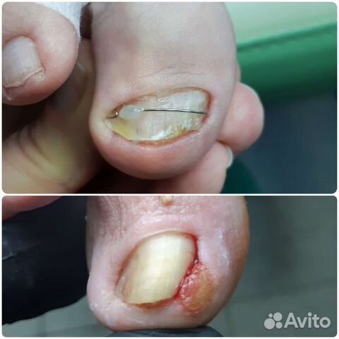 Подолог. Педикюр. Маникюр